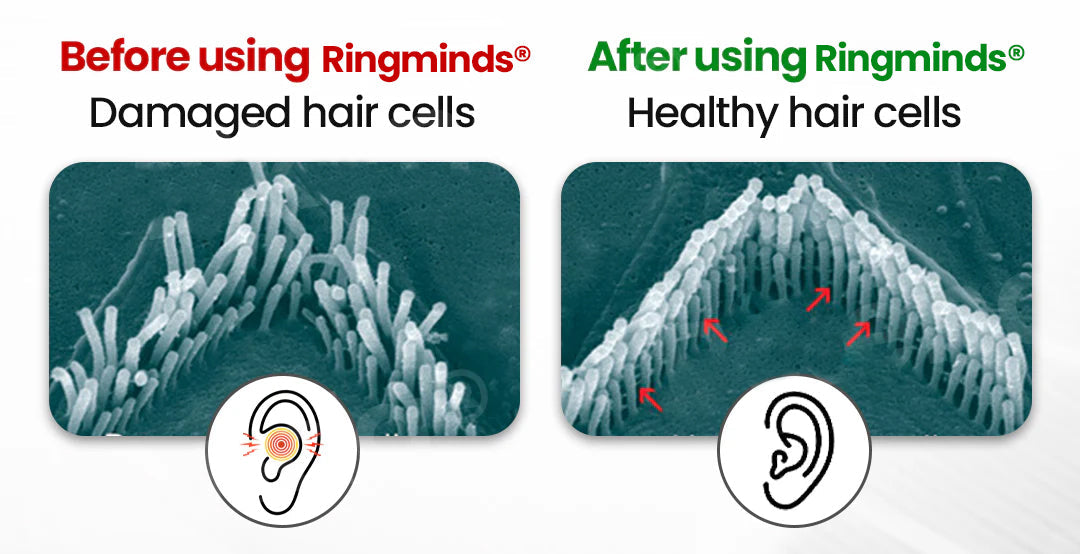 Ringminds® NeuroPulse Silence Pro