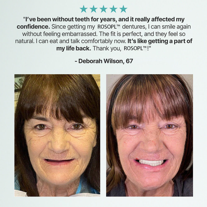 🌎Ends Today: 70% OFF! ⏰ Custom-Fit Full Functional Dentures| Smile with Confidence